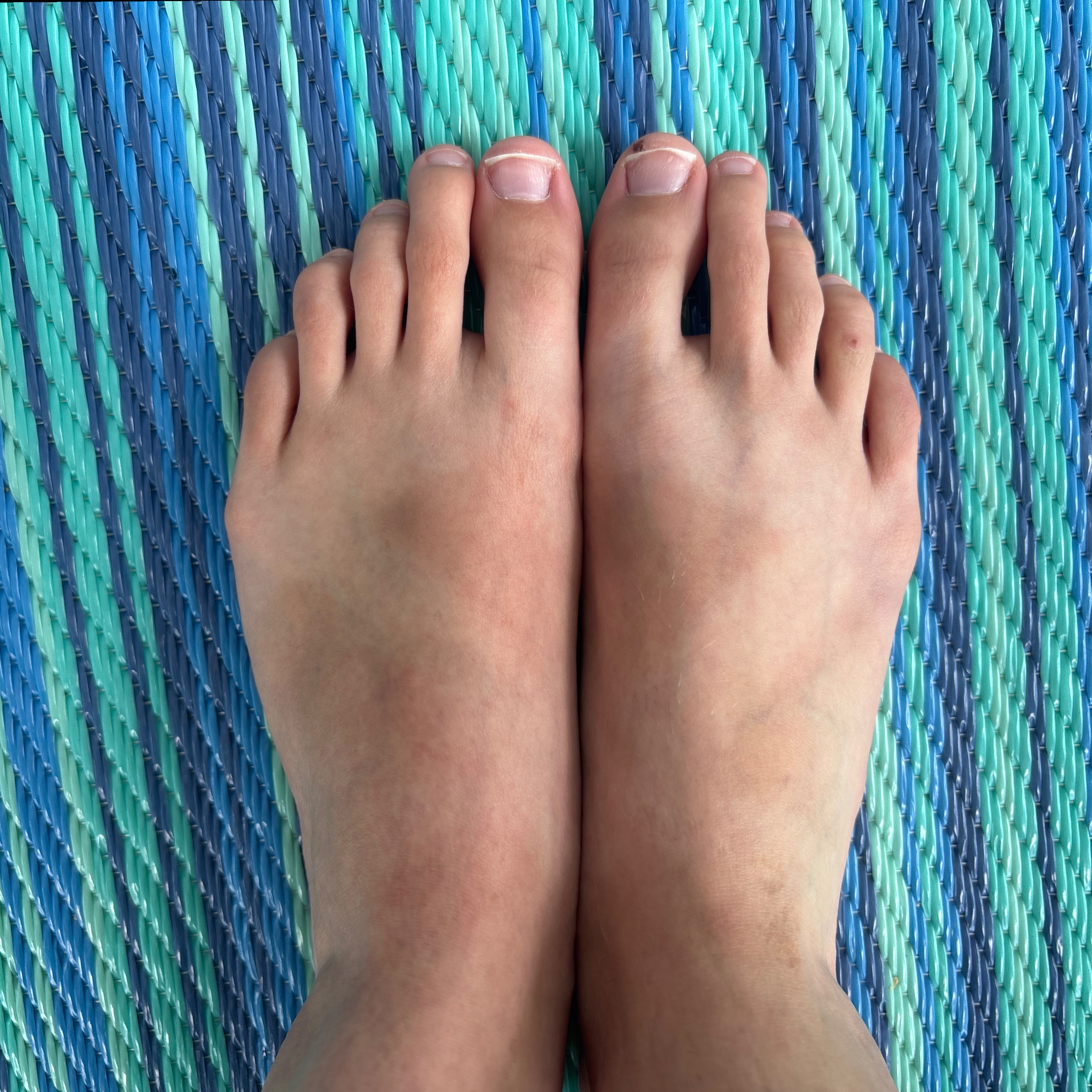 longtootsies