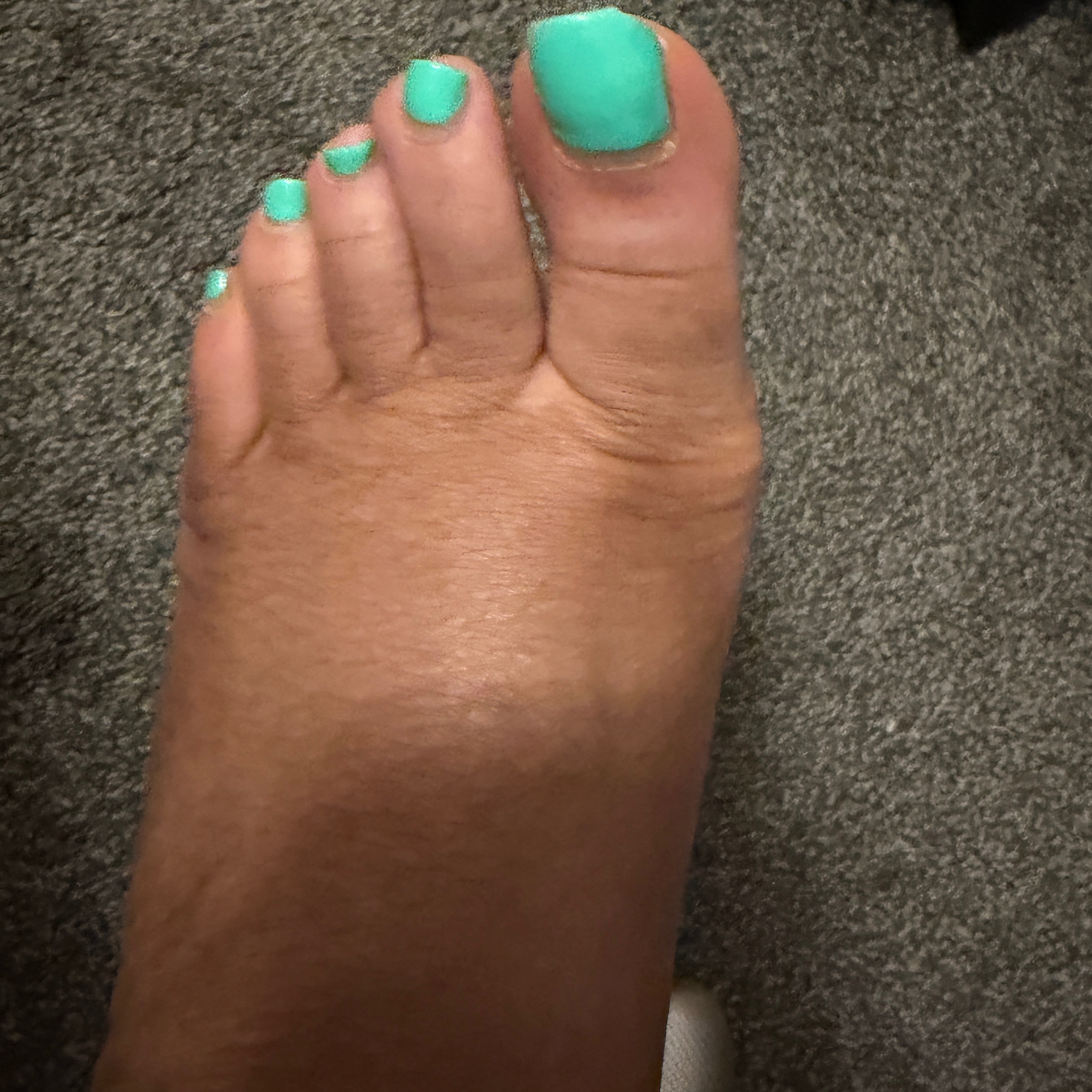Preenfeet
