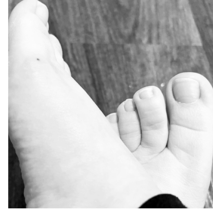 HeatWaveToes