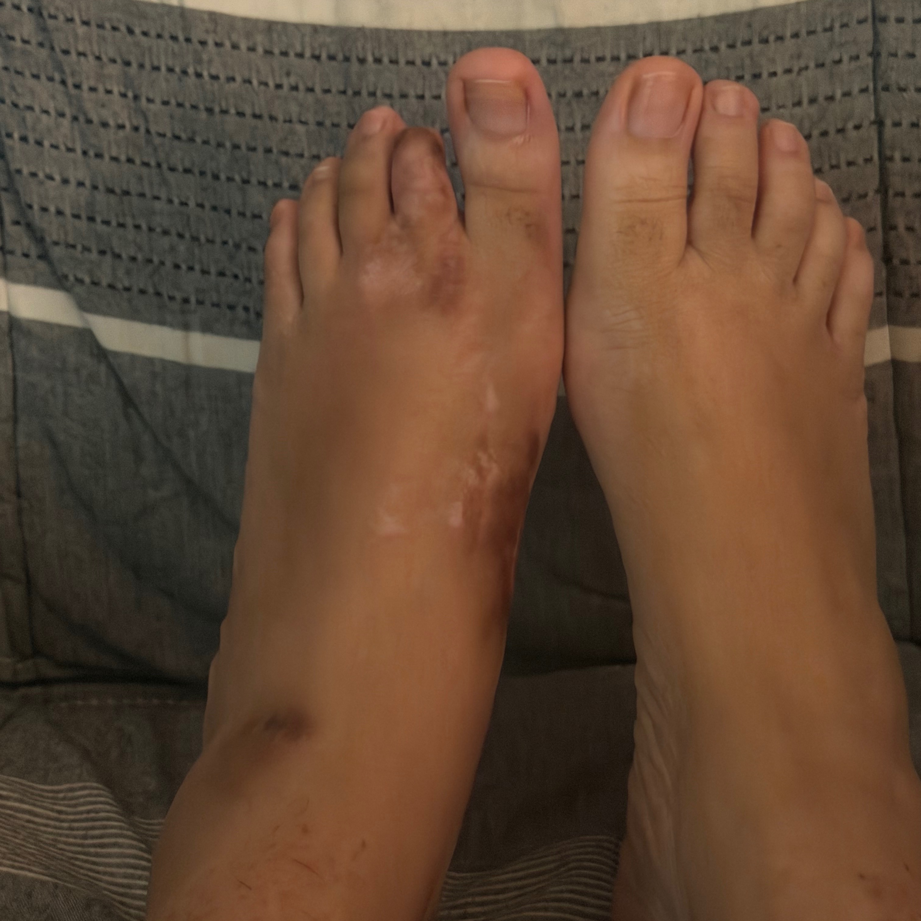 heifer9hoof