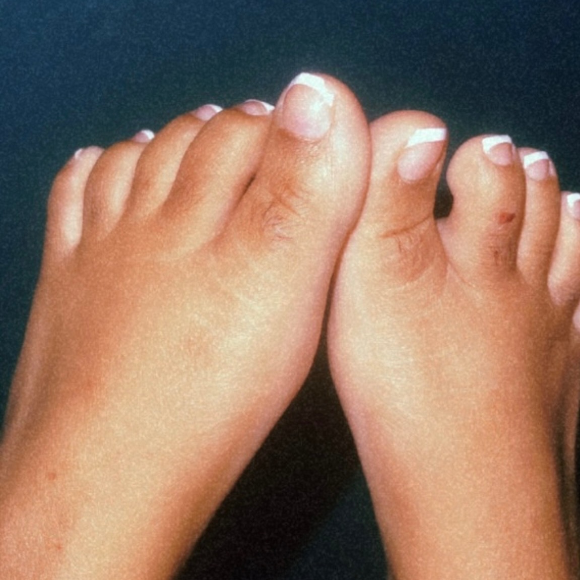 PrettyFeet_Cee