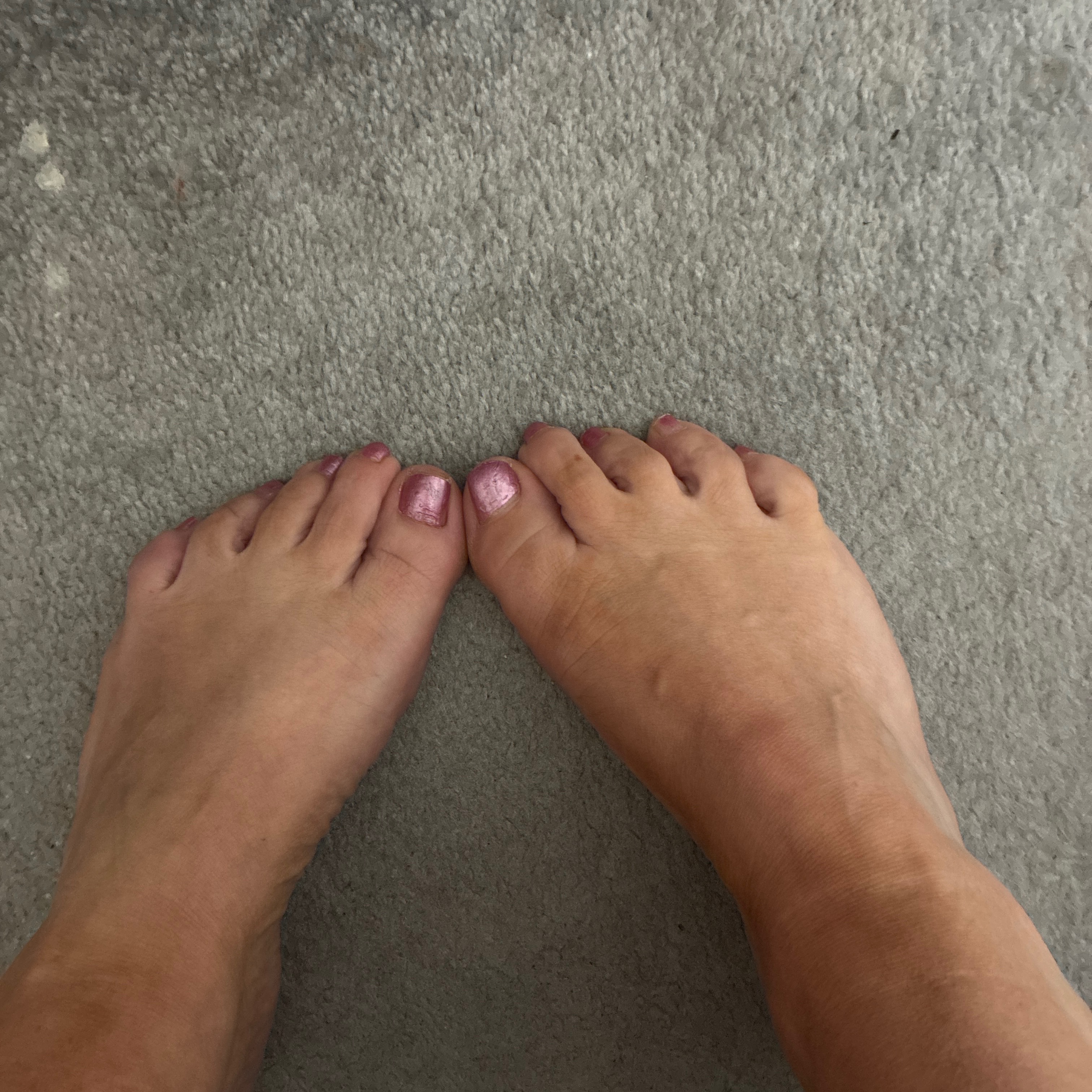 Feet4us