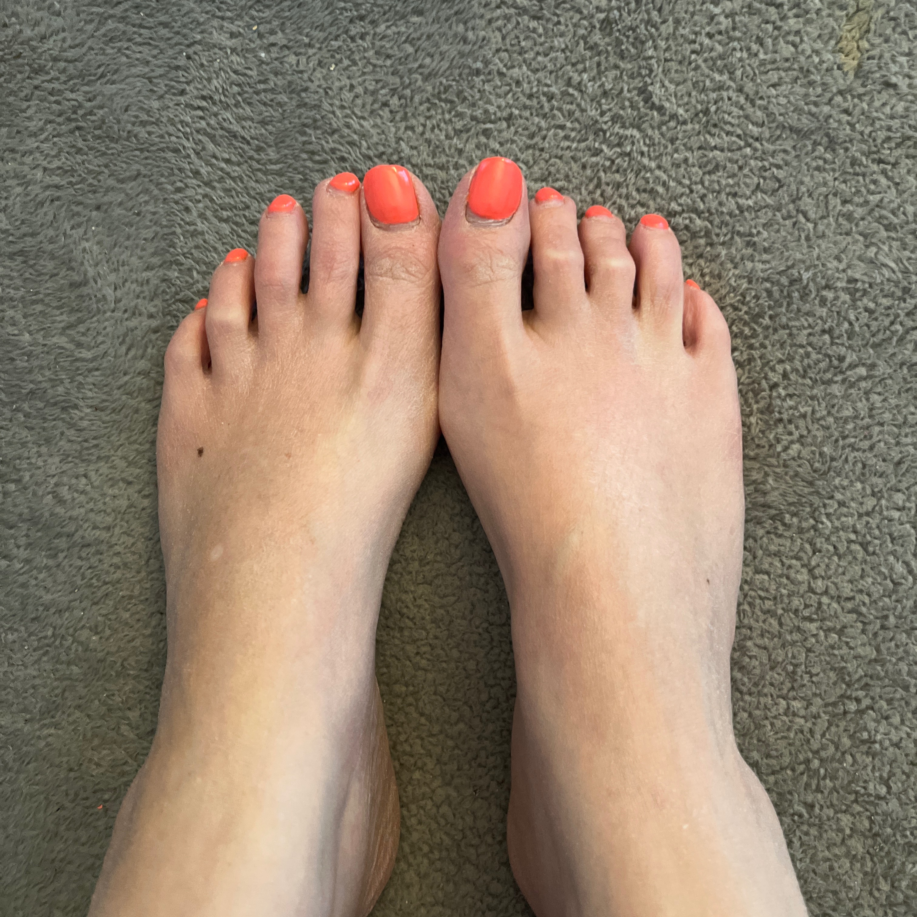hotfoot82