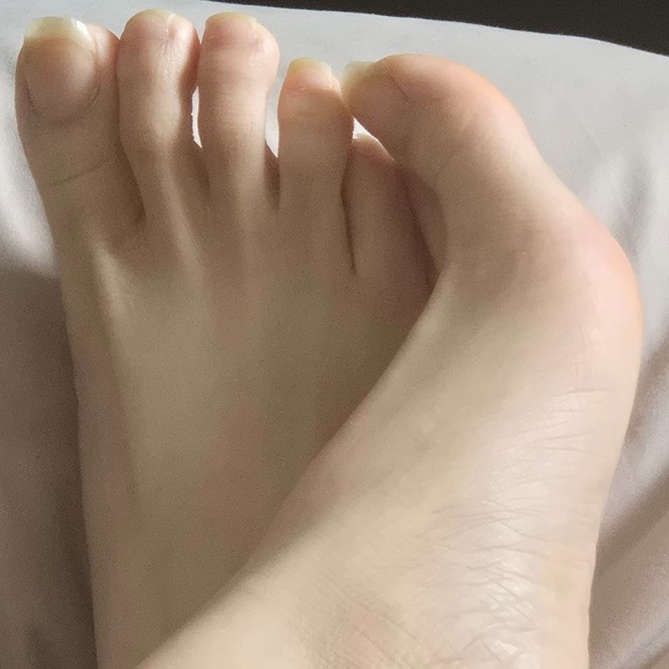asiatoptoe