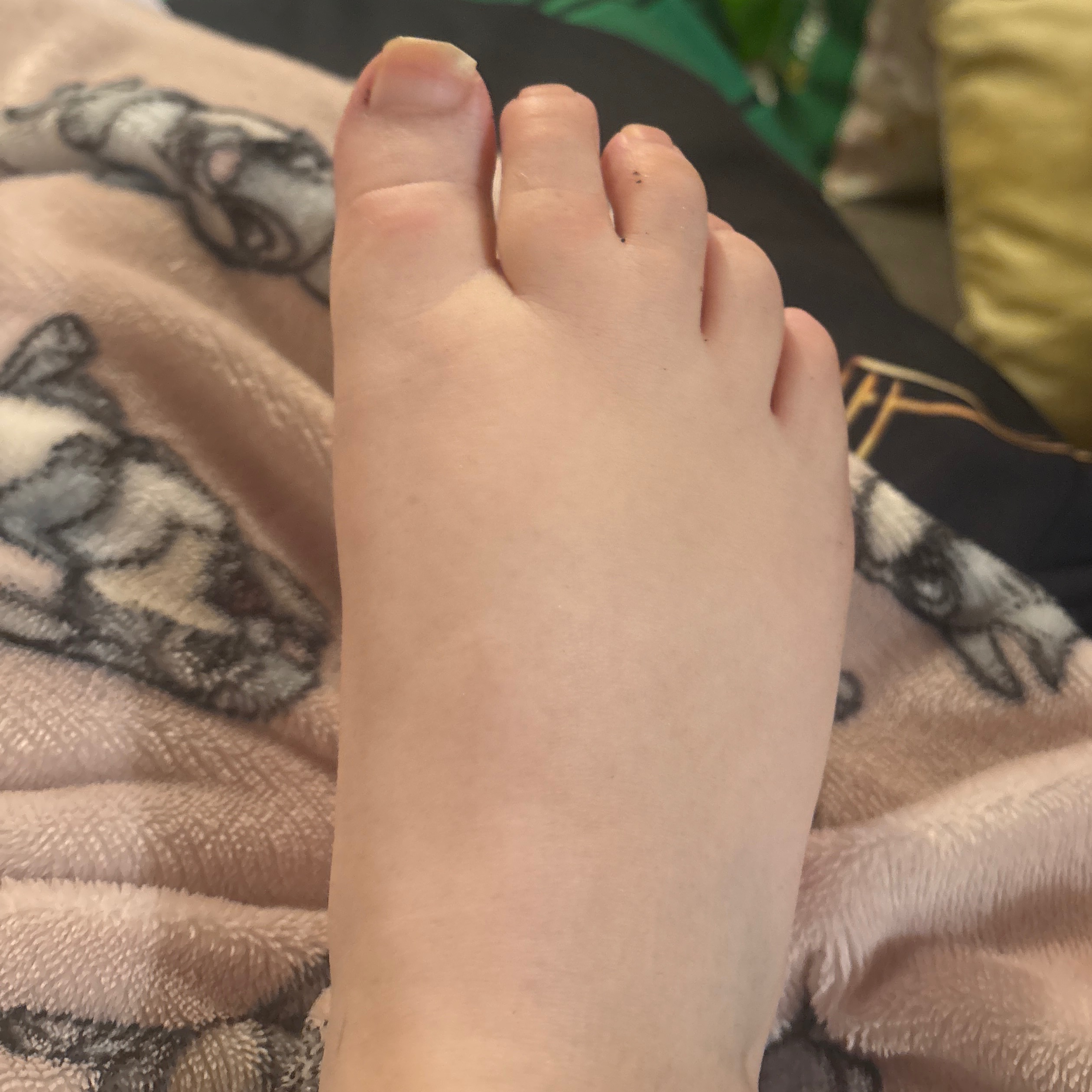 babytoes