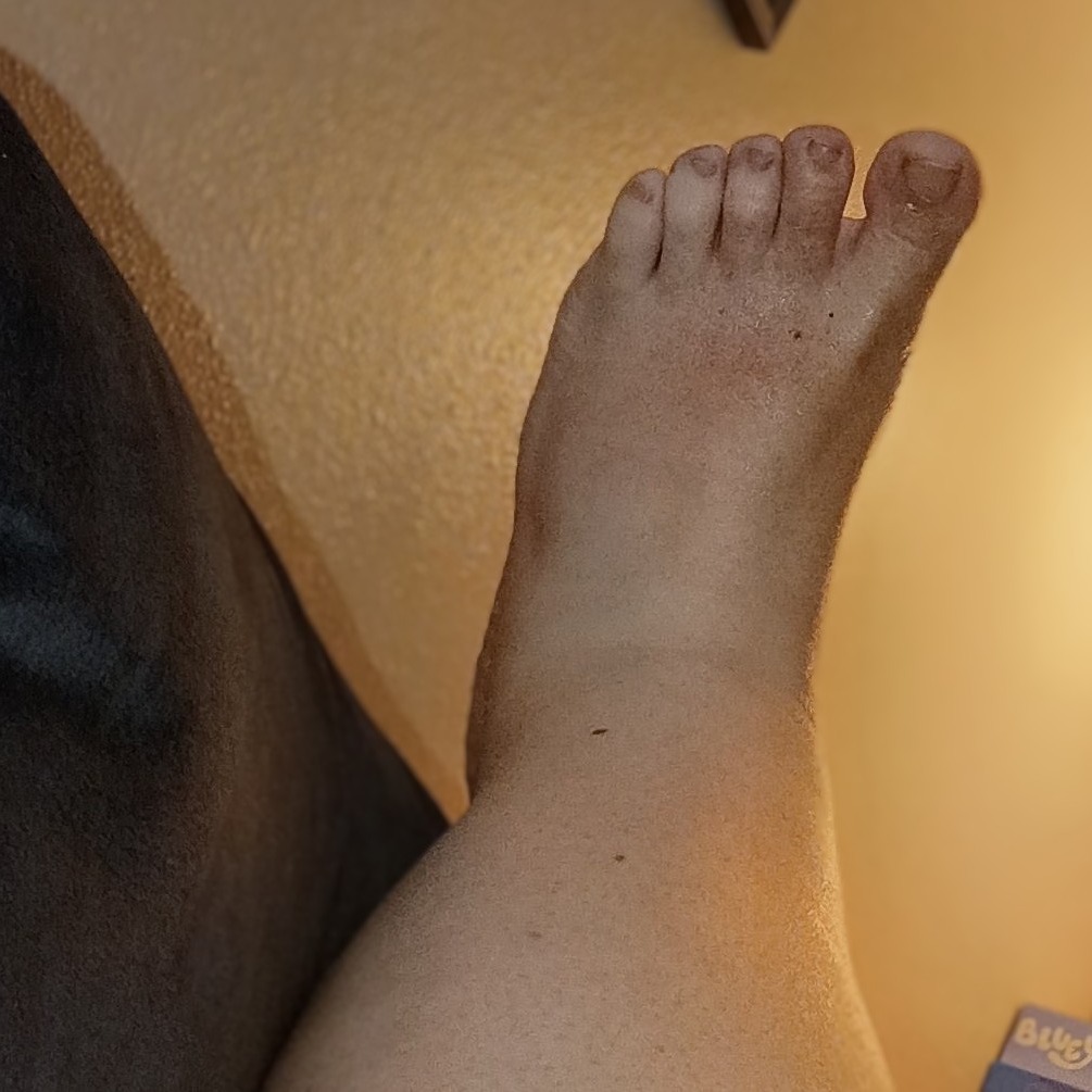 bigsquish