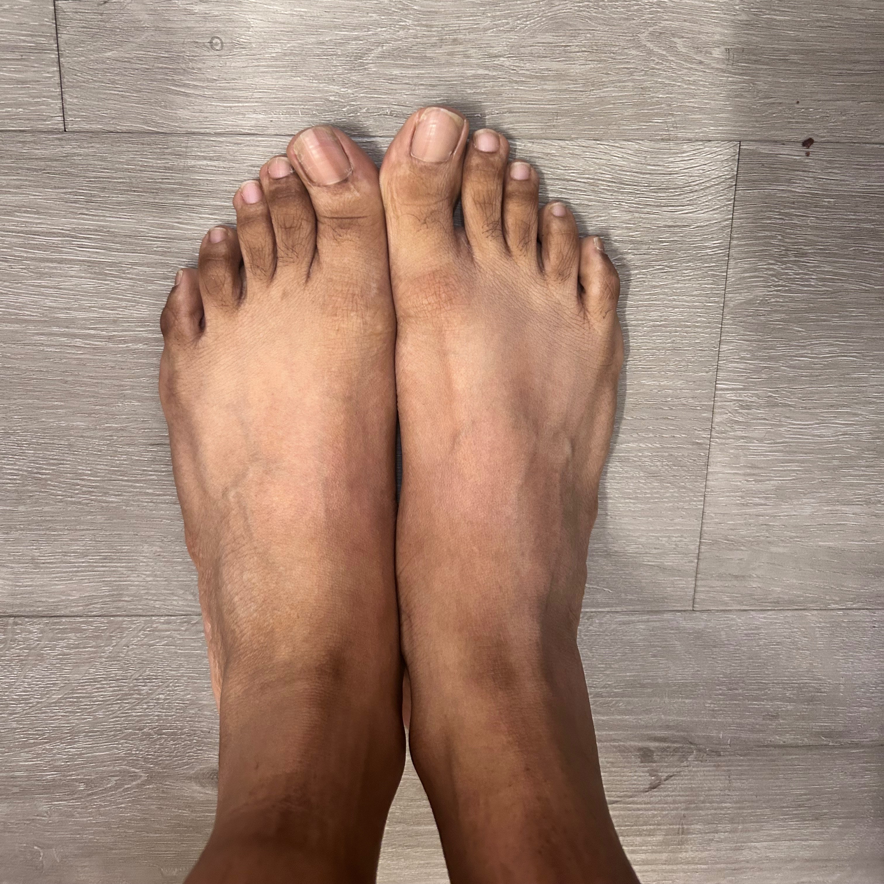 crookedtoes515
