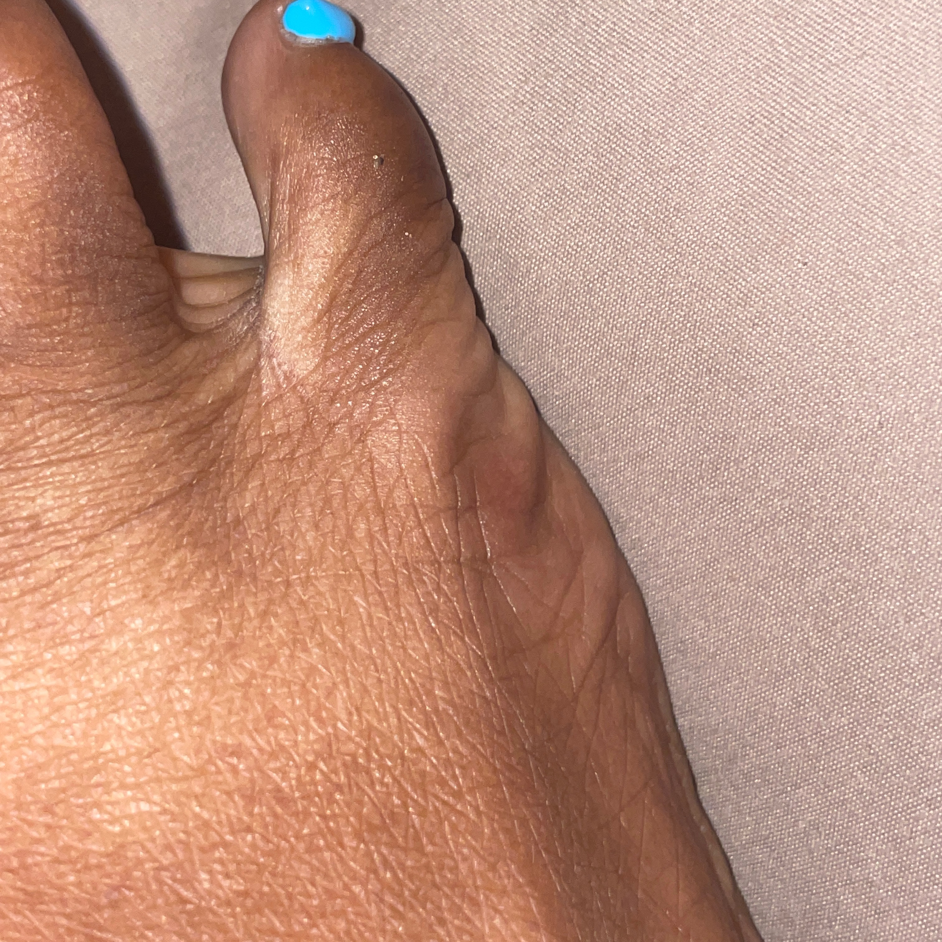 Urelitenessfeetness
