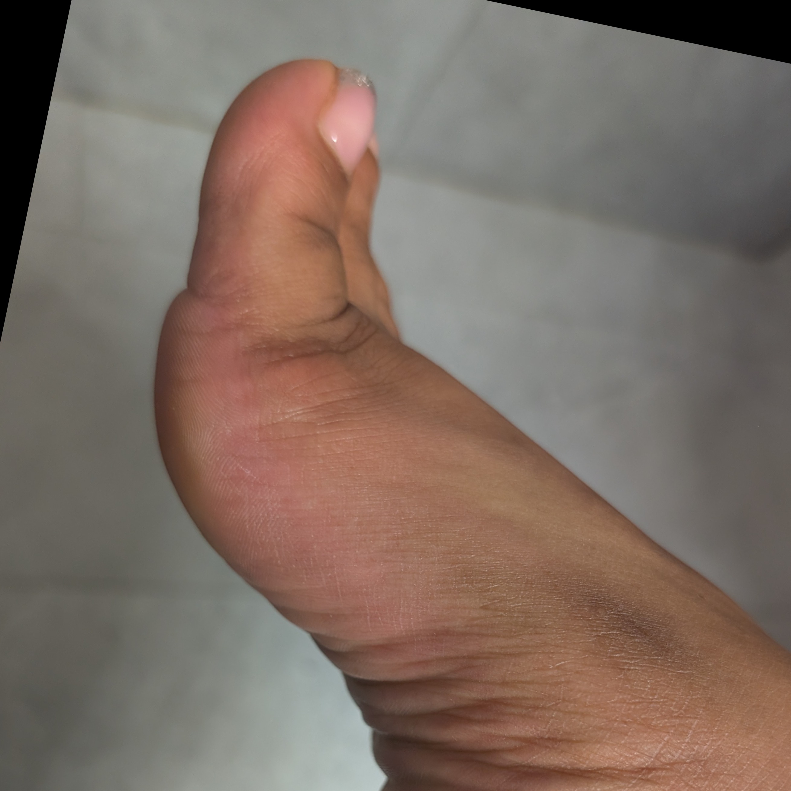 flightyfootphoenix
