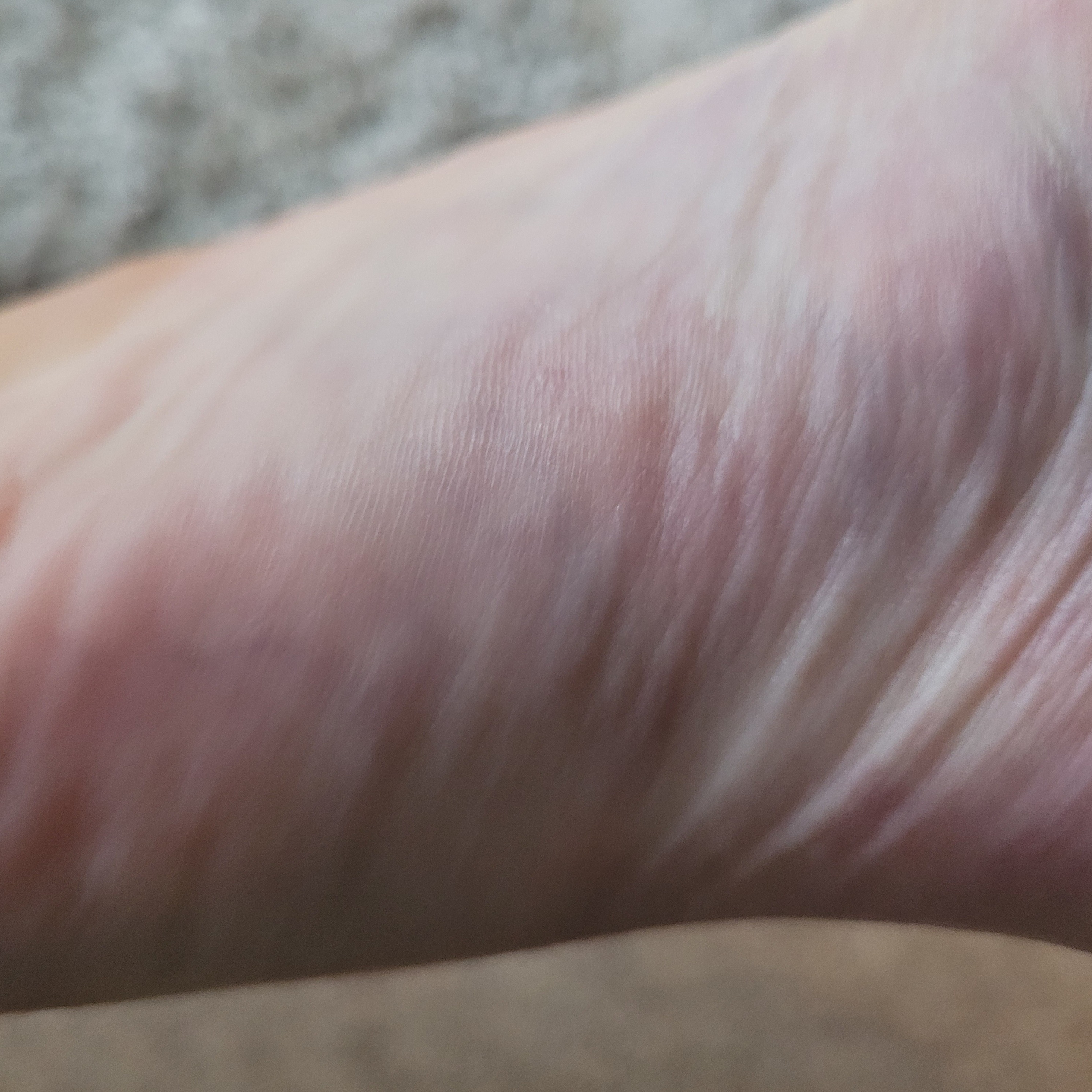 baresole