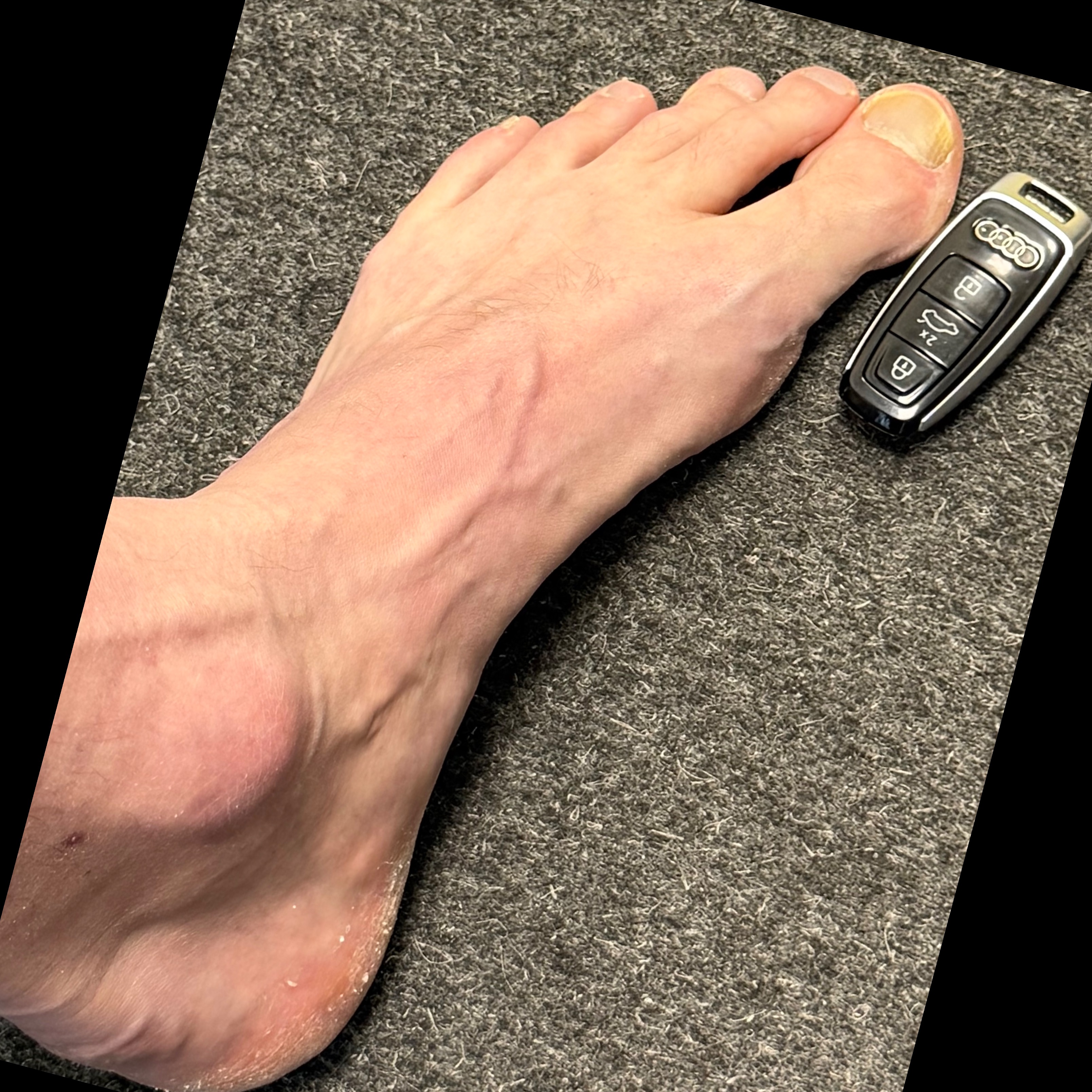 giantsole15