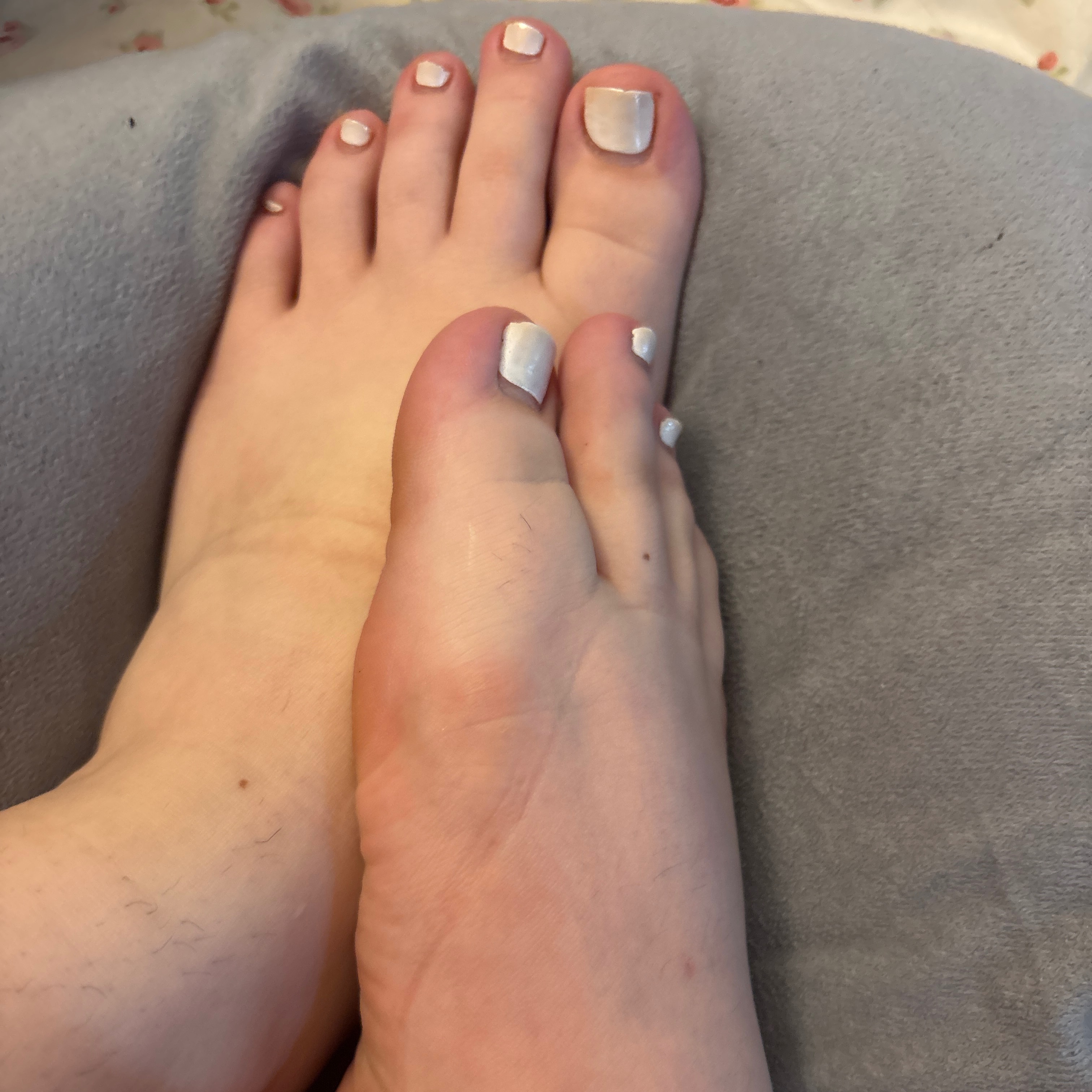 10toedbunny