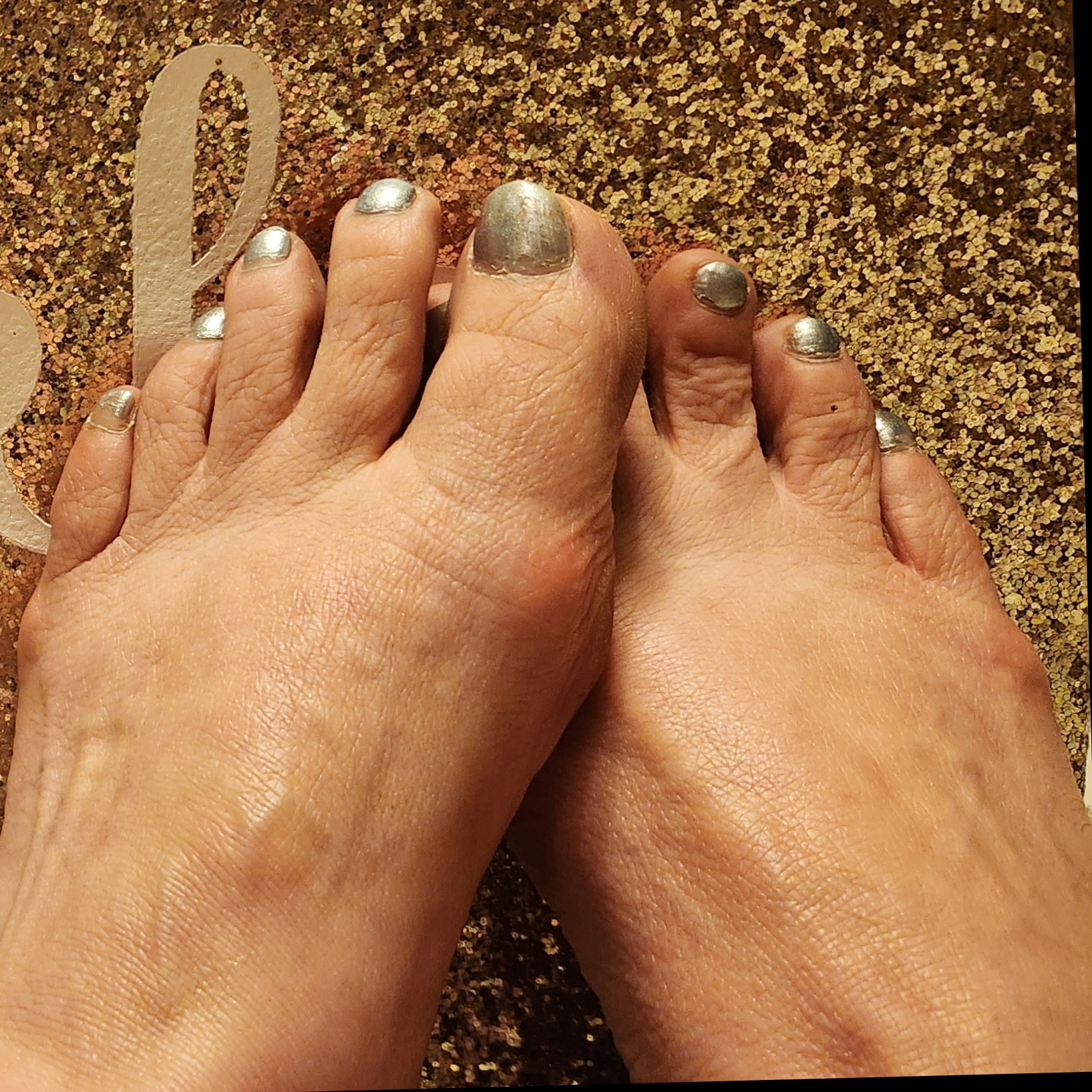 Toetallys