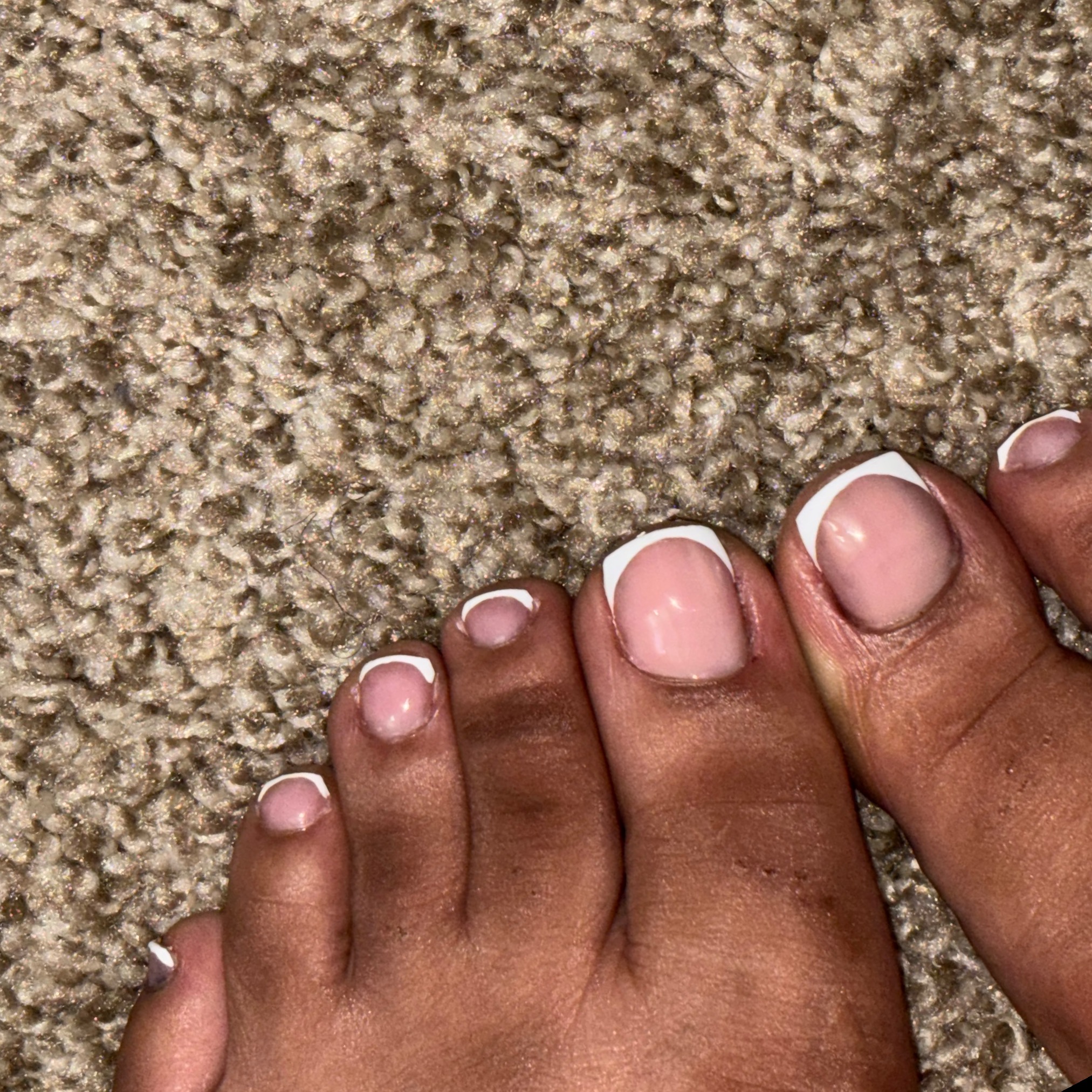 KissMyArchXo