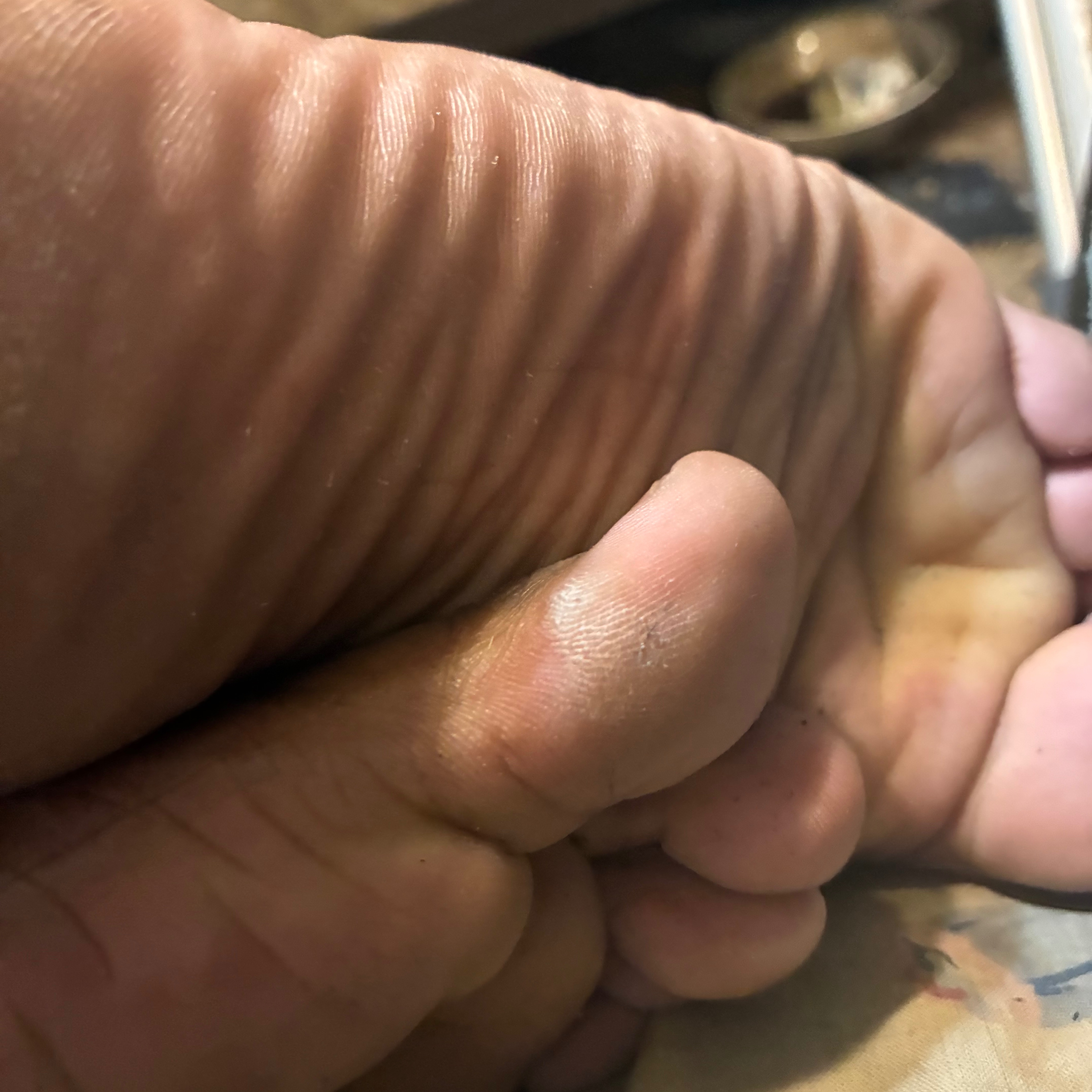 Wrinklyfeetsoleslover