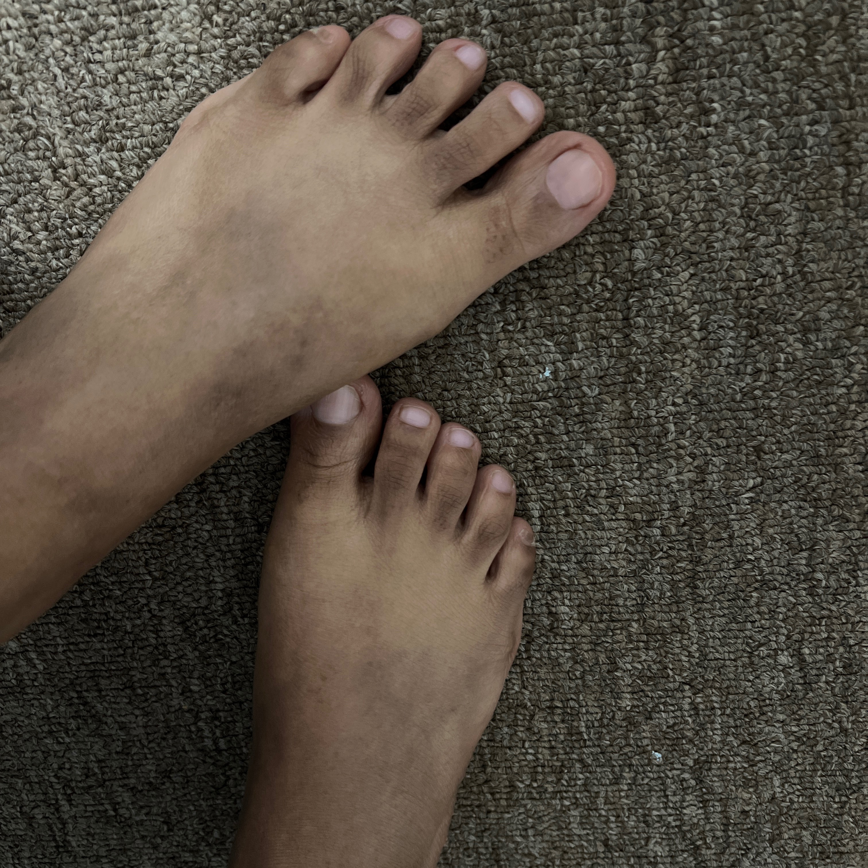 tinyfootsie