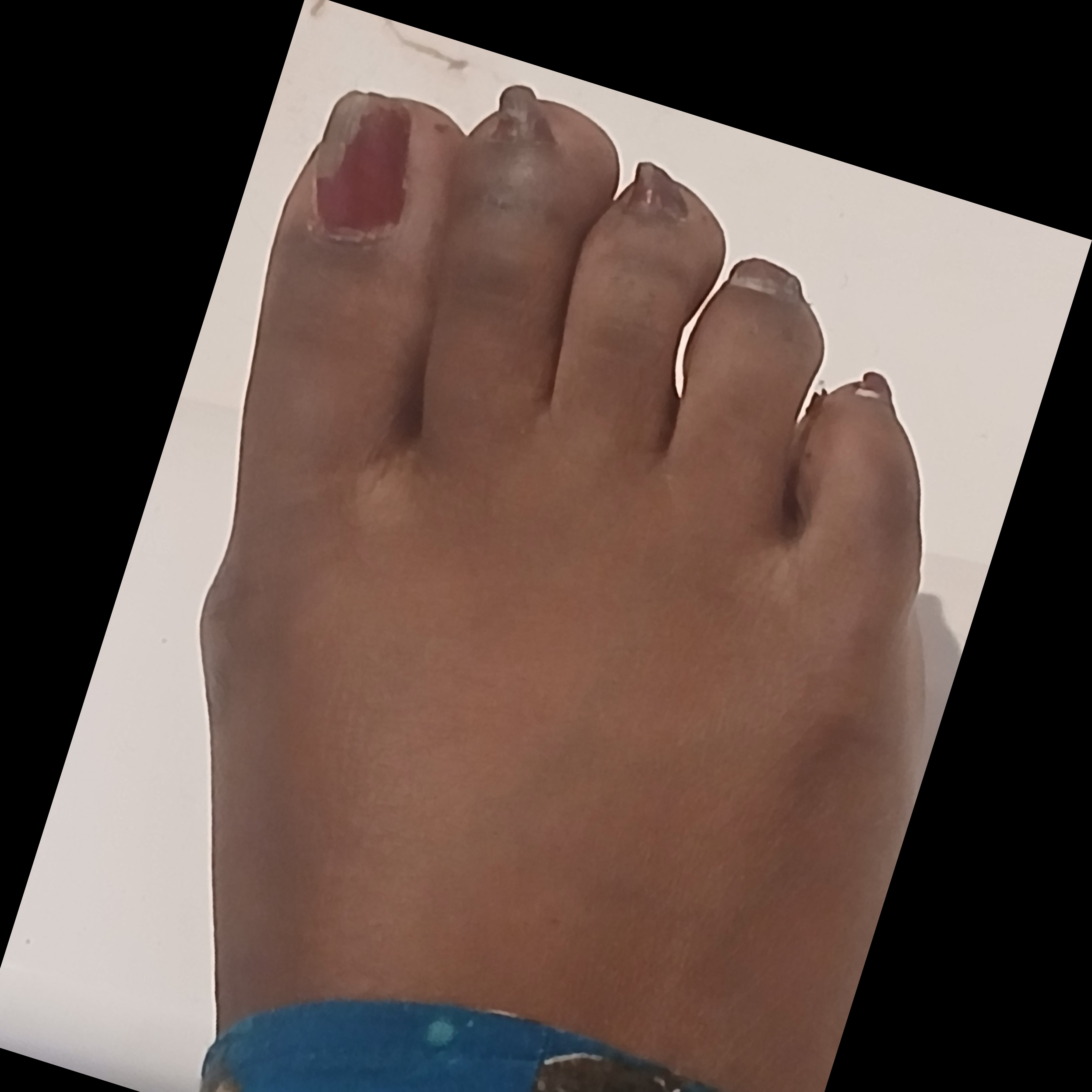 stugglesugarfeet91