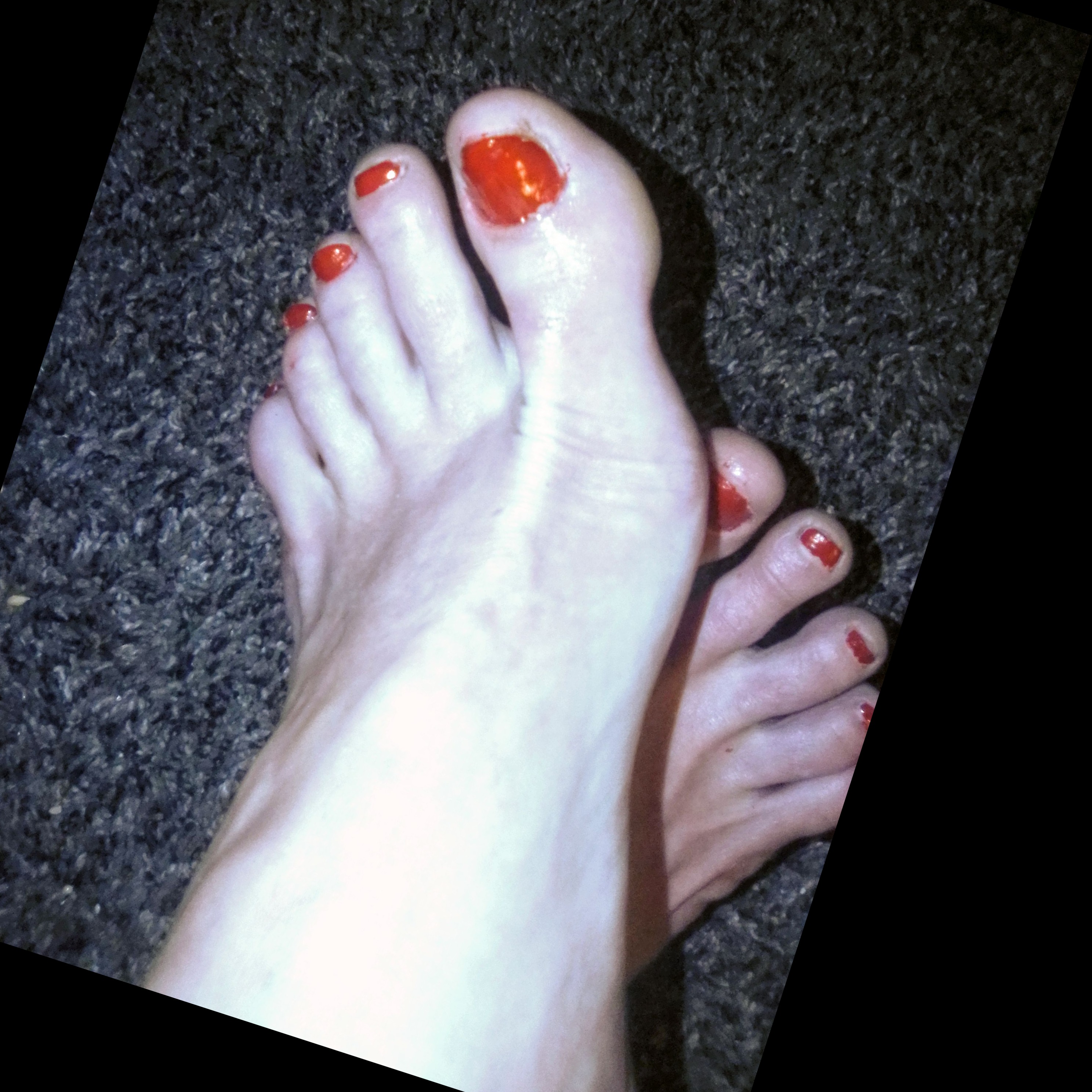 Frillyfeet